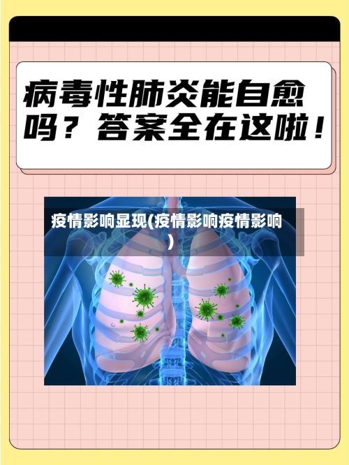 疫情影响显现(疫情影响疫情影响)-第3张图片